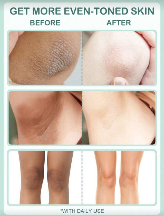 TRSTAY Skin Brightening Cream, Skin Lightening For Intimate Areas