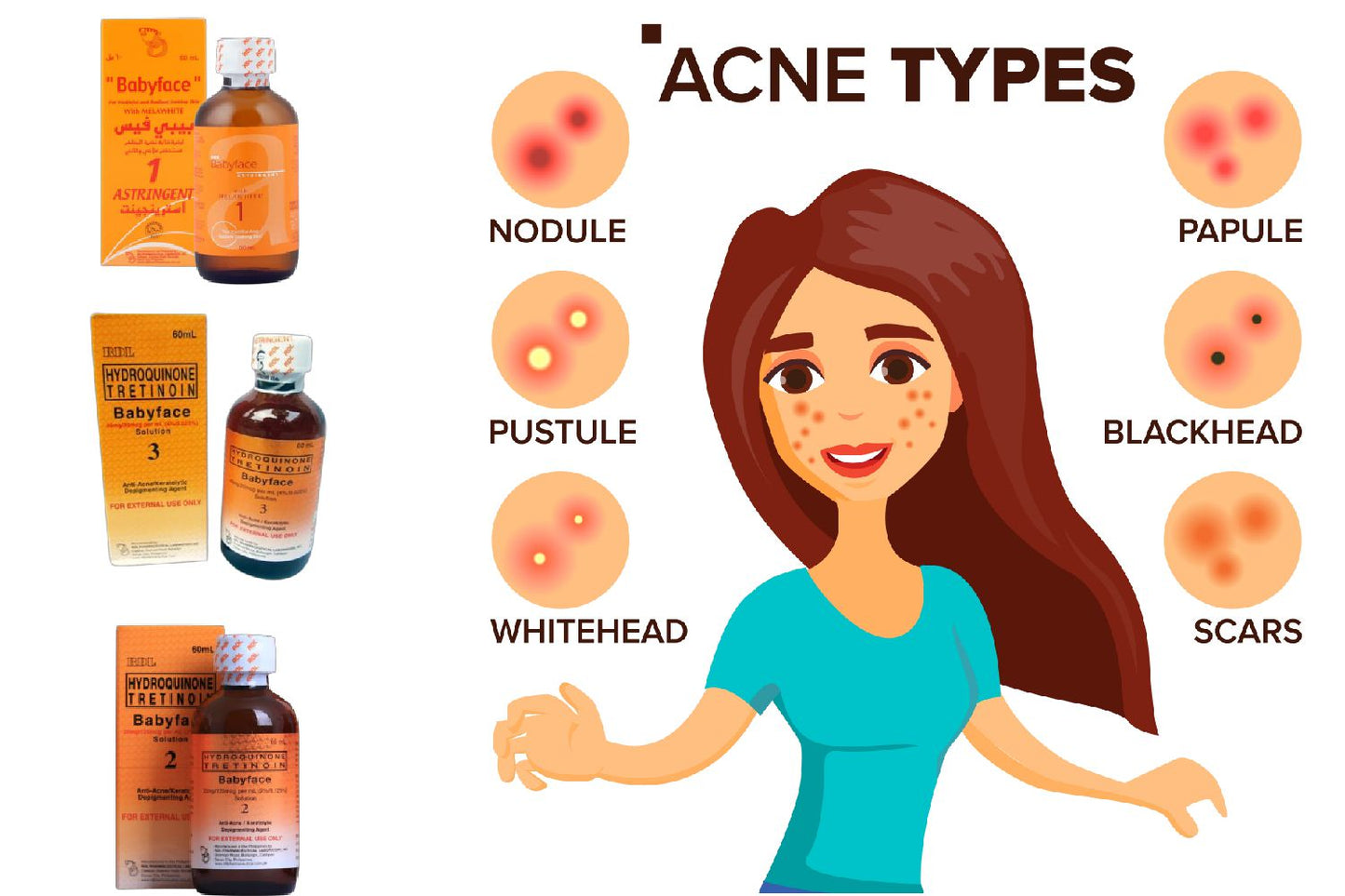 Babyface Hydroquinone Tretinoin Face Lotion - Trillingo Express Online Marketplace