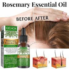 Eelhoe Rosemary Essential Hair Growth Oil - Trillingo Express Online Marketplace