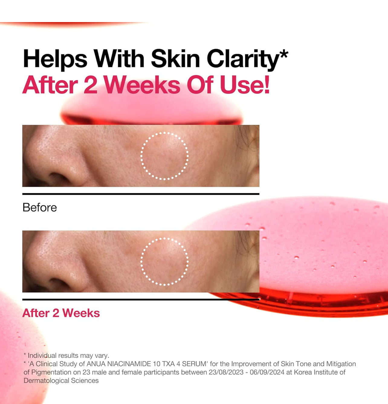 ANUA 10% Niacinamide+ 4% TXA Serum Dark Spot 30ml