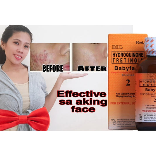 Babyface Hydroquinone Tretinoin Face Lotion - Trillingo Express Online Marketplace
